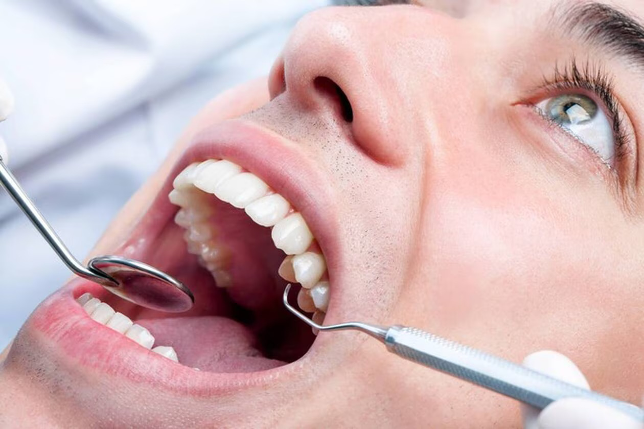 Chirurgie cosmétique dentaire Maroc, Clinique Longchamp Casablanca