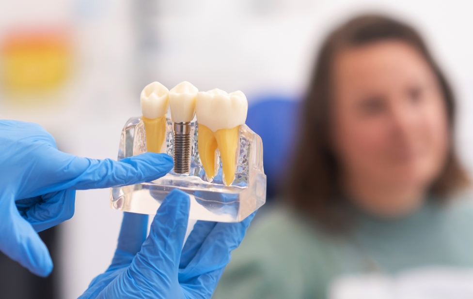 Dental Implants for Teens: When Are They Appropriate?