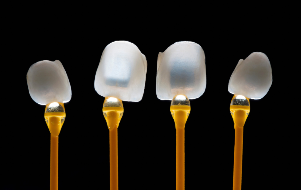 Opt for dental veneers, the discreet solution for vibrant teeth