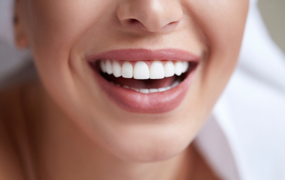 How to Prepare Your Teeth for Optimal Teeth Whitening