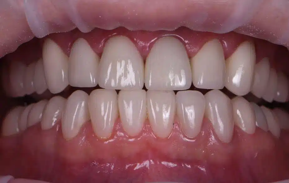 Mauvaise haleine à Casablanca : causes, prévention et traitement | Clinique Dentaire Longchamp